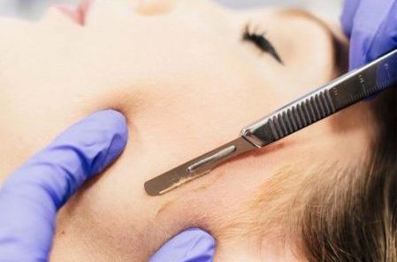 Pittsburgh Dermaplaning - Reveal Skin & Beauty Spa, Dermaplaning Facials, Chemical Peels, Acne Facial, Customized Facials, Bridgeville Skincare Specialists, Pittsburgh Esthetician.