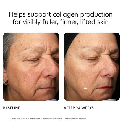 MGF Age Renewal Cream