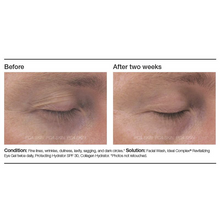 Load image into Gallery viewer, Ideal Complex Eye Gel
