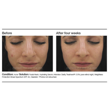 Load image into Gallery viewer, Intensive Clarity Treatment: 0.5% Pure Retinol

