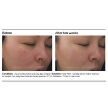 Load image into Gallery viewer, Retinol Treatment for Sensitive Skin
