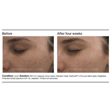 Load image into Gallery viewer, Intensive Clarity Treatment: 0.5% Pure Retinol
