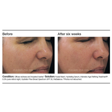 Load image into Gallery viewer, Intensive Age Refining Treatment: .05% Pure Retinol
